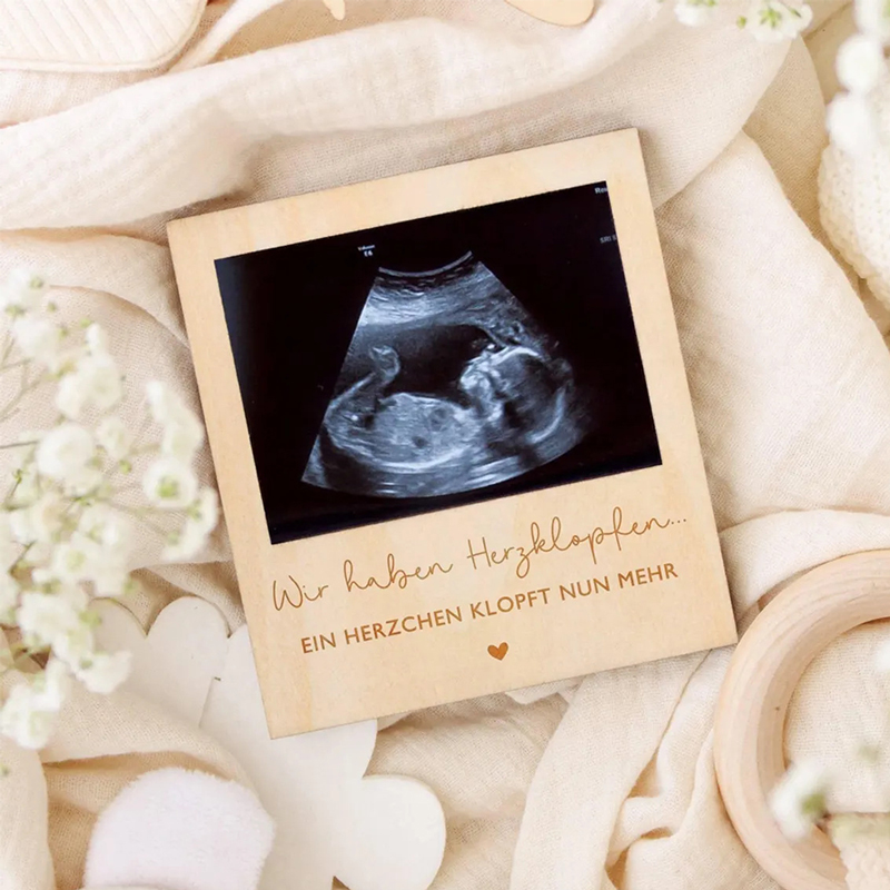 Ultrasound Pregnancy Announcem - Photo Booth Frame review and price